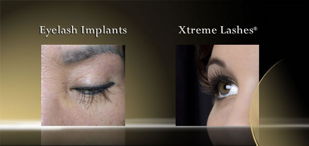 eyelashes implants