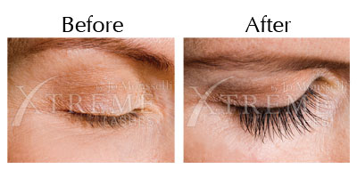 Eyelash extensions photo